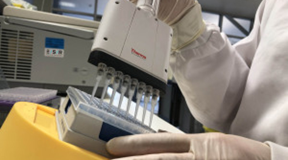 ESR Scientist Preparing A Polymerase Chain Reaction Test As Part Of Diagnostic Laboratory Testing For 2019 Novel Coronavirus Fitwzmwmcwzmdbd 2020
