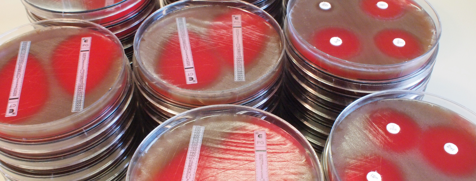 Antimicrobial Health AMR