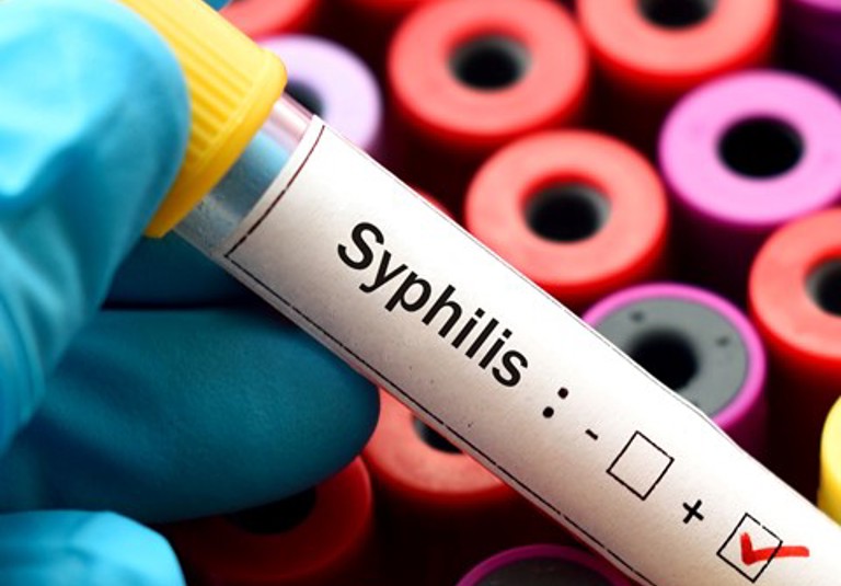 ESR data shows congenital syphilis on the rise and ongoing inequities ...
